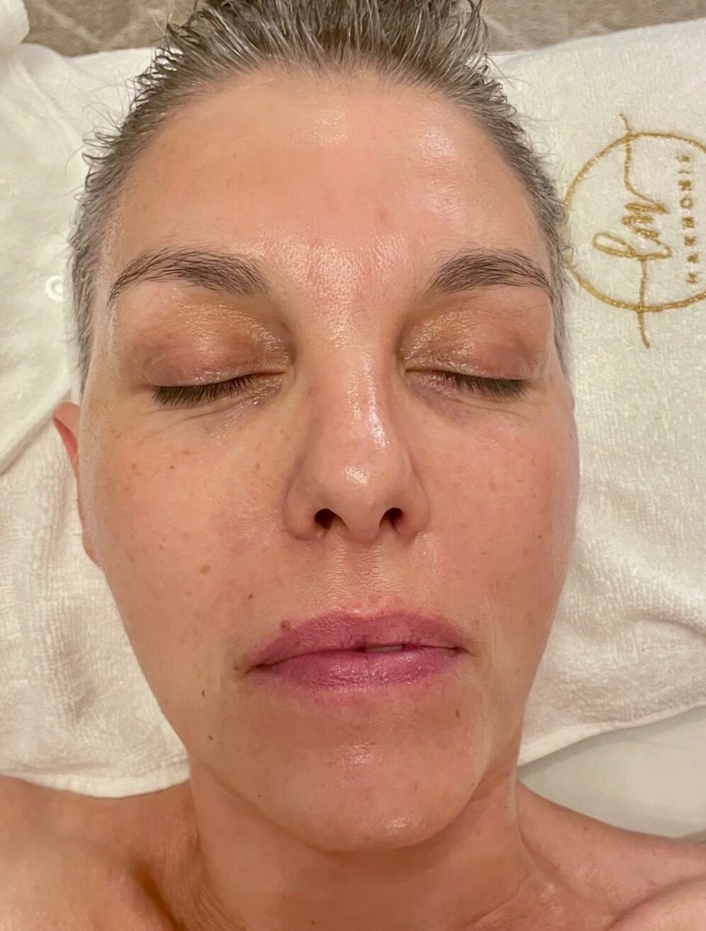 Visage cliente après séance de massage liftant japonais Kobidô chez LM Harmonie Marseille : teint lumineux et traits repulpés